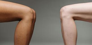 M&eacute;dicos de Mundo pide formar a los sanitarios para prevenir la mutilaci&oacute;n genital femenina