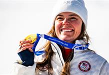 Las medallas de Mil&aacute;n Cortina 2026, bajo investigaci&oacute;n por defecto de f&aacute;brica