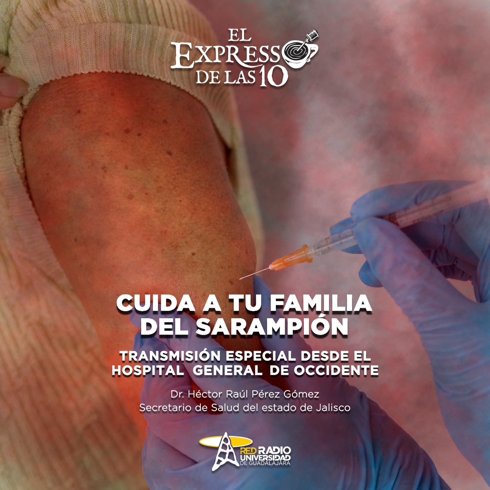 Cuida a tu familia del sarampión - El Expresso de las 10 - Ma. 17 Febrero 2026 Cuida a tu familia del sarampión - El Expresso de las 10 - Ma. 17 Febrero 2026