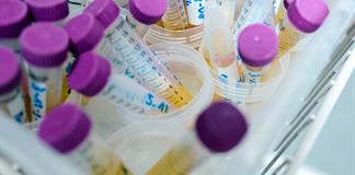 Detectan en ni&ntilde;os toxina perjudicial para la reproducci&oacute;n