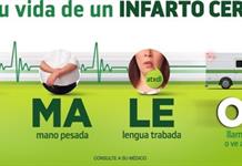 “Camaleón”, el acrónimo clave para detectar un derrame cerebral a tiempo
