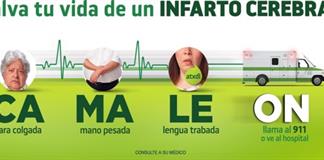 "Camale&oacute;n", el acr&oacute;nimo clave para detectar un derrame cerebral a tiempo
