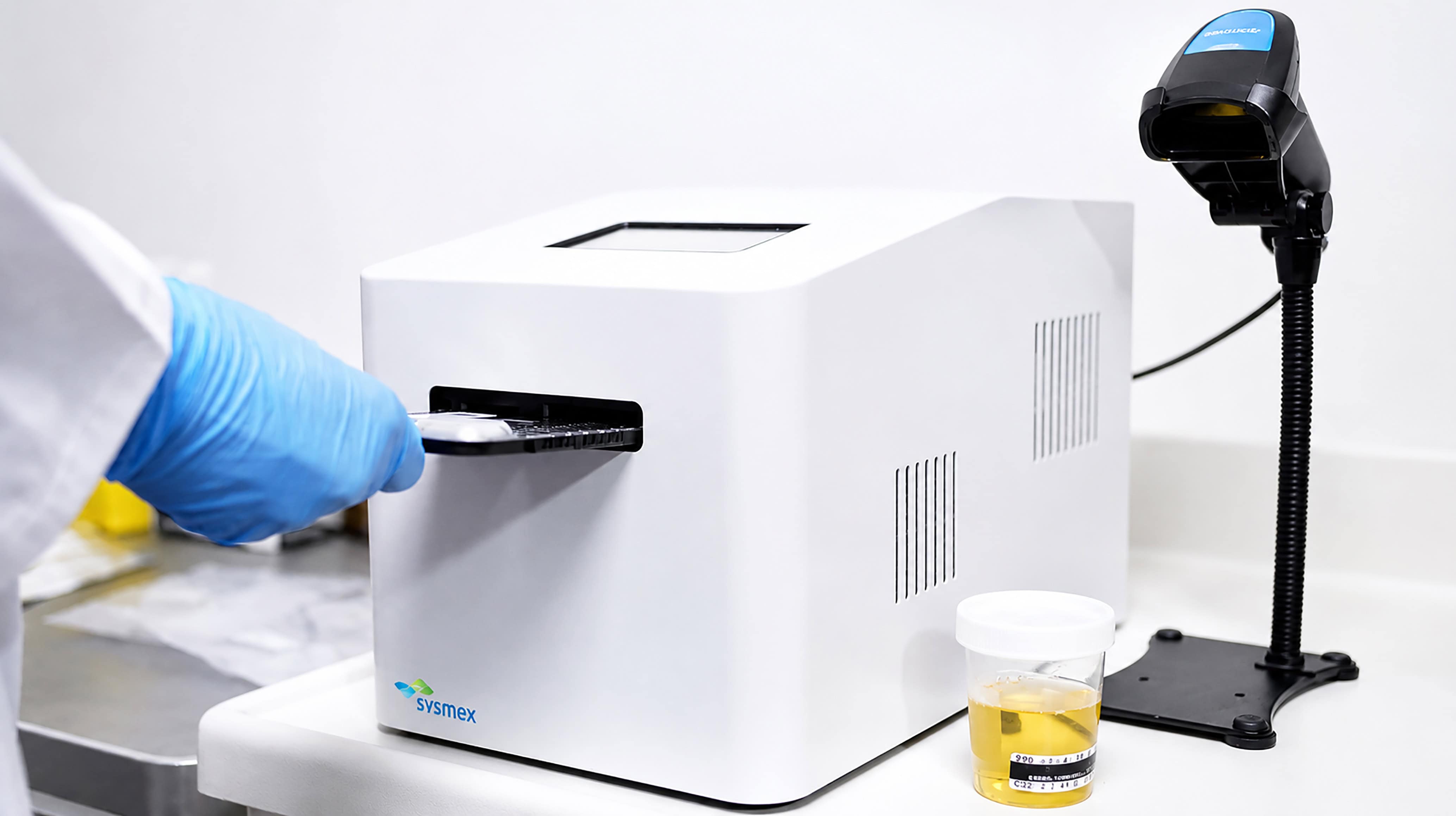 Infecciones urinarias: avances en detección y prevención