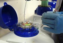 Los factores ambientales son determinantes en la calidad del semen Los factores ambientales son determinantes en la calidad del semen
