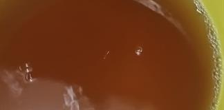 Pese a crisis de agua sucia, SSJ descarta incremento atípico de infecciones Pese a crisis de agua sucia, SSJ descarta incremento atípico de infecciones