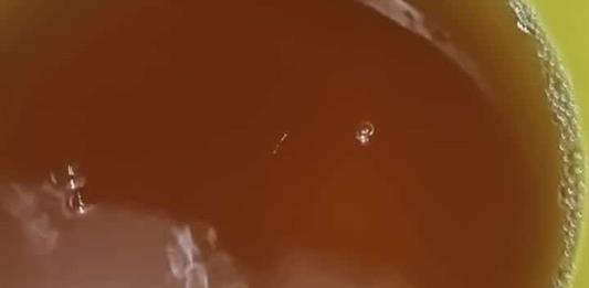 Pese a crisis de agua sucia, SSJ descarta incremento atípico de infecciones
