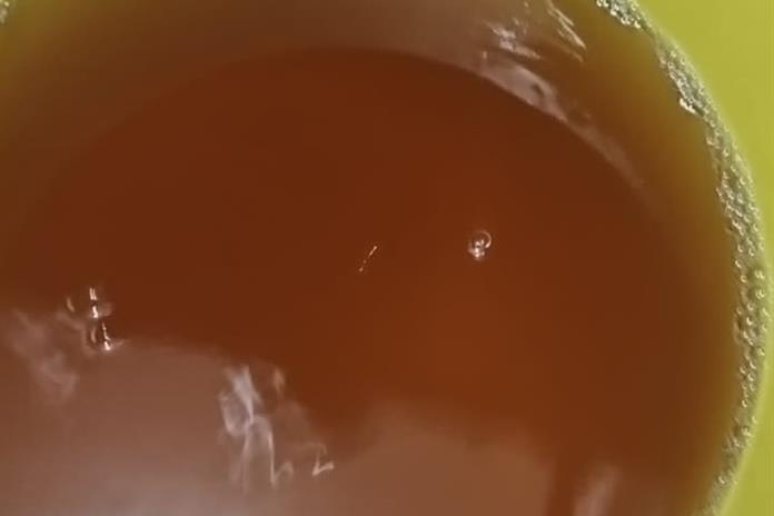 Pese a crisis de agua sucia, SSJ descarta incremento atípico de infecciones Pese a crisis de agua sucia, SSJ descarta incremento atípico de infecciones