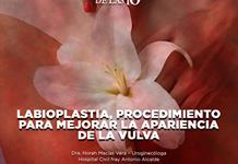 Labioplastia, procedimiento para mejorar la apariencia de la vulva- El Expresso de las 10- Ju. 09 Julio 2026 Labioplastia, procedimiento para mejorar la apariencia de la vulva- El Expresso de las 10- Ju. 09 Julio 2026
