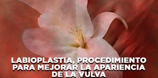 Labioplastia, procedimiento para mejorar la apariencia de la vulva- El Expresso de las 10- Ju. 09 Julio 2026 Labioplastia, procedimiento para mejorar la apariencia de la vulva- El Expresso de las 10- Ju. 09 Julio 2026