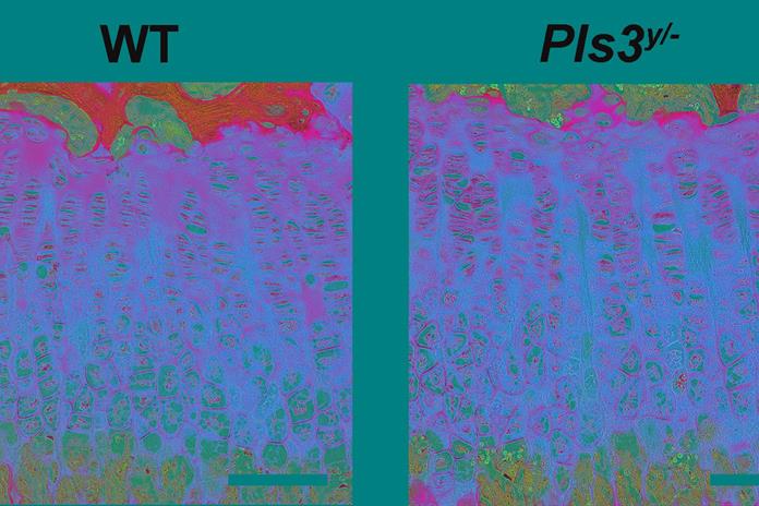 Trazan un mapa genético de las células y genes que regulan las enfermedades de los huesos Trazan un mapa genético de las células y genes que regulan las enfermedades de los huesos