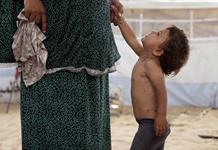 Unicef alerta brote reciente de varicela en Gaza Unicef alerta brote reciente de varicela en Gaza
