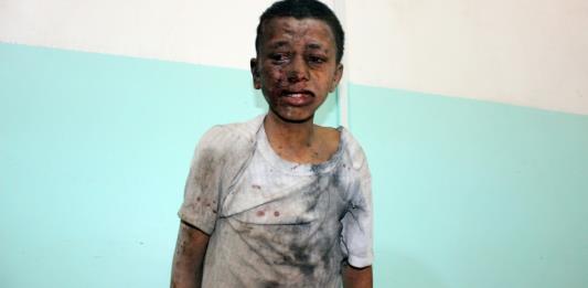 Al menos 29 niños mueren en un ataque contra un autobús en Yemen