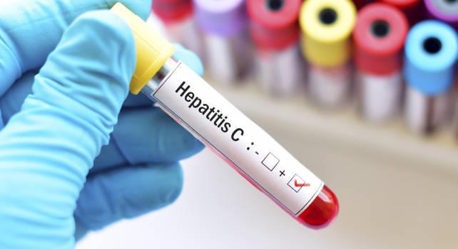 Realizarán campaña de pruebas rápidas de Hepatitis C en Tototlán