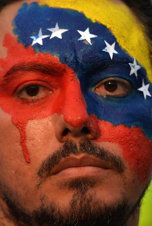 Nos acribillaron: El lamento de manifestantes heridos en Venezuela