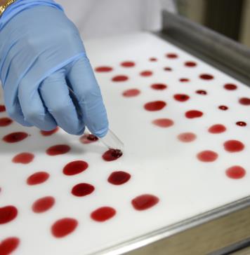 Uno de cada 10.000 mexicanos padece hemofilia pero la mitad no lo sabe