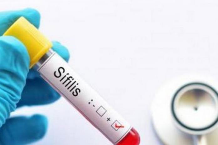 Aumento de infecciones de transmisión sexual (ITS) en Europa