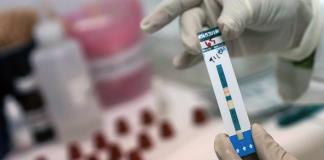 Realizarán pruebas masivas para detectar VIH en todo el estado