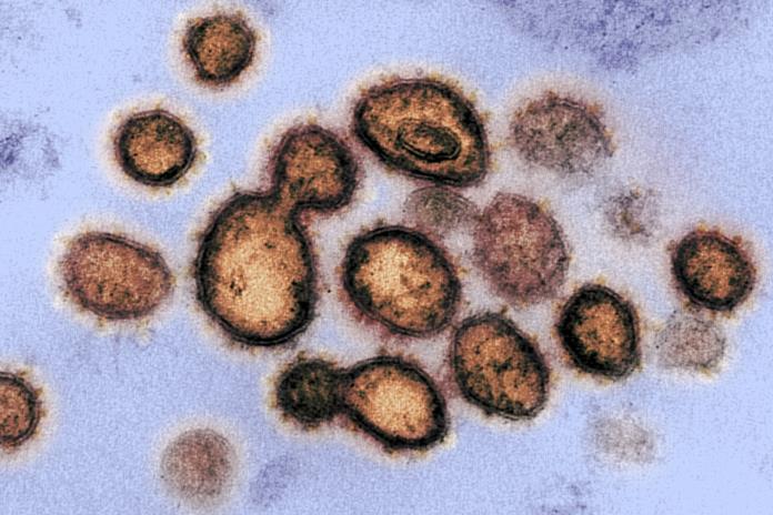 El coronavirus permanece en habitaciones y baños, pero los desinfectantes lo matan
