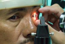 En el Día Mundial contra el Glaucoma, médicos recuerdan que puede detenerse si se detecta a tiempo