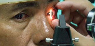 En el Día Mundial contra el Glaucoma, médicos recuerdan que puede detenerse si se detecta a tiempo