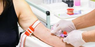 La hepatitis C sí se cura, el diagnóstico y tratamiento es gratis