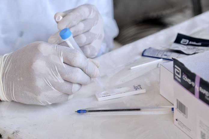 Crecen los precios de las pruebas anticovid en la metrópoli… y nadie denuncia