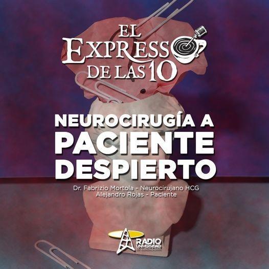 NEUROCIRUGÍA A PACIENTE DESPIERTO - El Expresso de las 10 - Ma. 31 May 2022