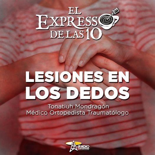 LESIONES EN LOS DEDOS - El Expresso de las 10 - Ma. 05 Jul 2022