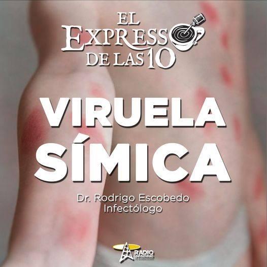 VIRUELA SÍMICA - El Expresso de las 10 - Lu. 04 Jul 2022