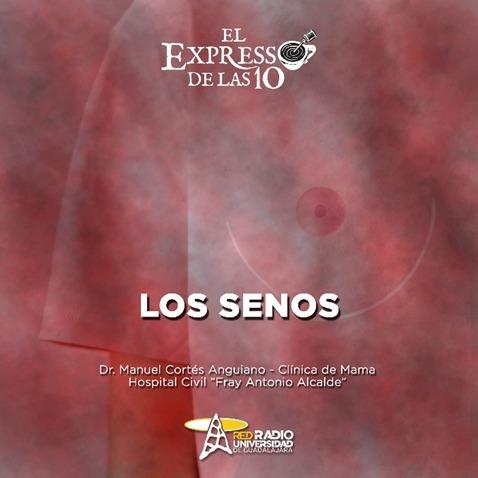LOS SENOS - El Expresso de las 10 - Ju. 09 Feb 2023