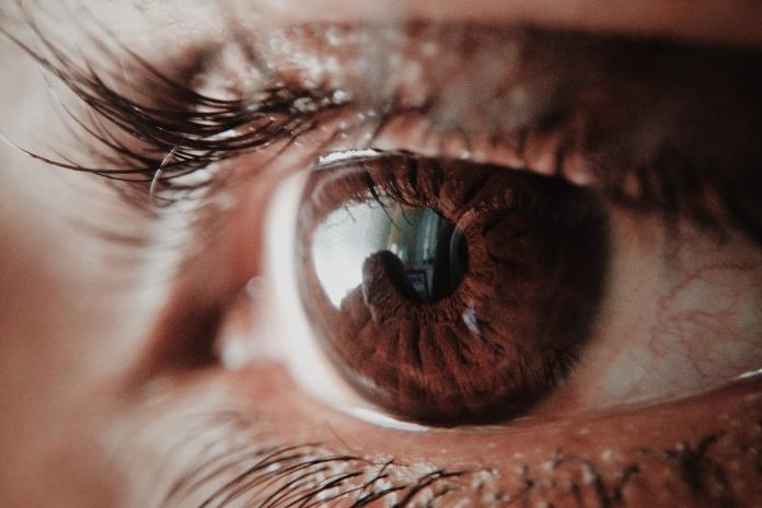 La carnosidad en los ojos no es un asunto menor, llama especialista a revisión