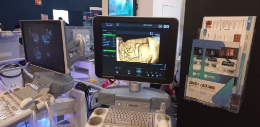 La inteligencia artificial ya llegó a los equipos de diagnóstico médico en Jalisco